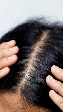 Scalp Care